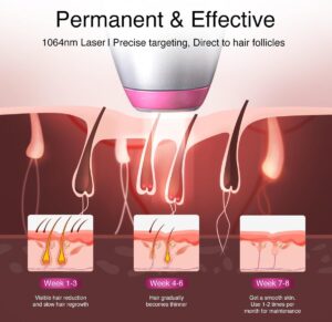 DermRays Epilation laser a diode 1064 nm pour femmes et hommes, pour tons de peau 1-6, refroidissement par glace, epilation grand an